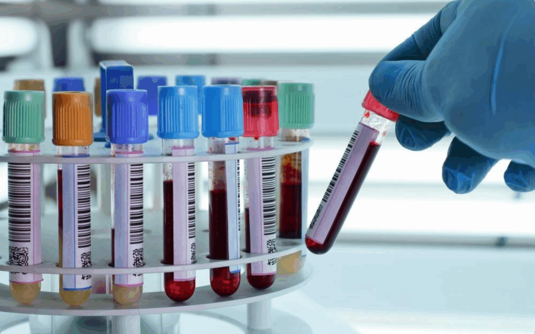 Top 10 Blood Tests Everyone Should Do Once a Year